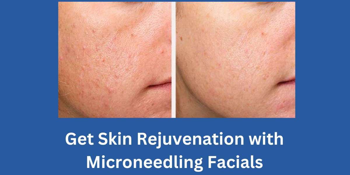 Get Skin Rejuvenation with Microneedling Facials